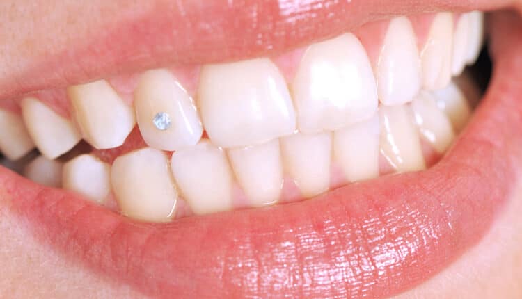 tooth gem