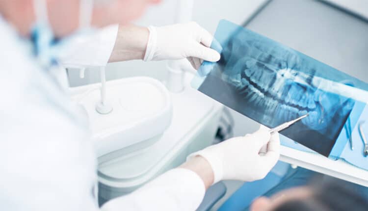 Dental x-ray
