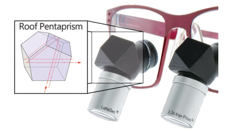 Ergonomically Optimal Loupes Support Proper Practice Posture - Decisions in  Dentistry