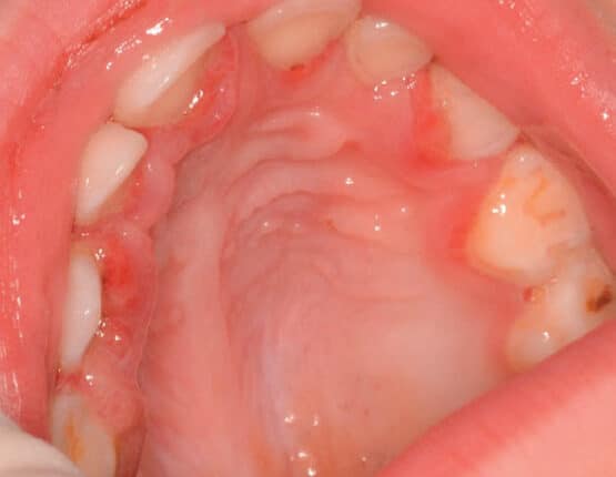 oral-systemic-health-2