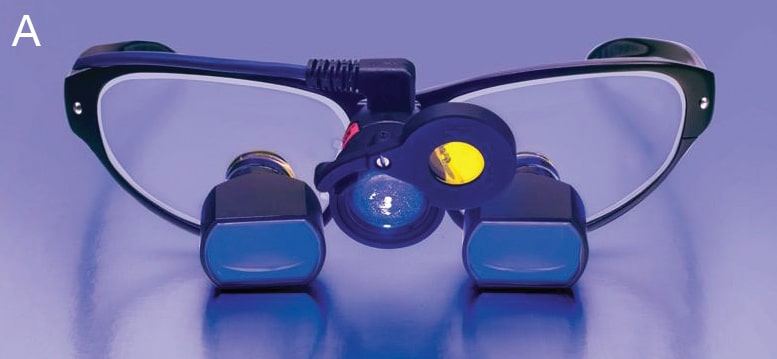 FIGURE 2A. Loupes with fluorescent illumination.