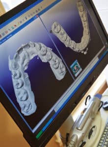 3d Scab of mouth