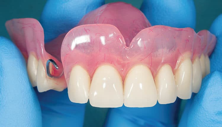 Care Strategies for Removable Dental Prostheses - Decisions in Dentistry