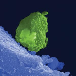 hydroxyapatite