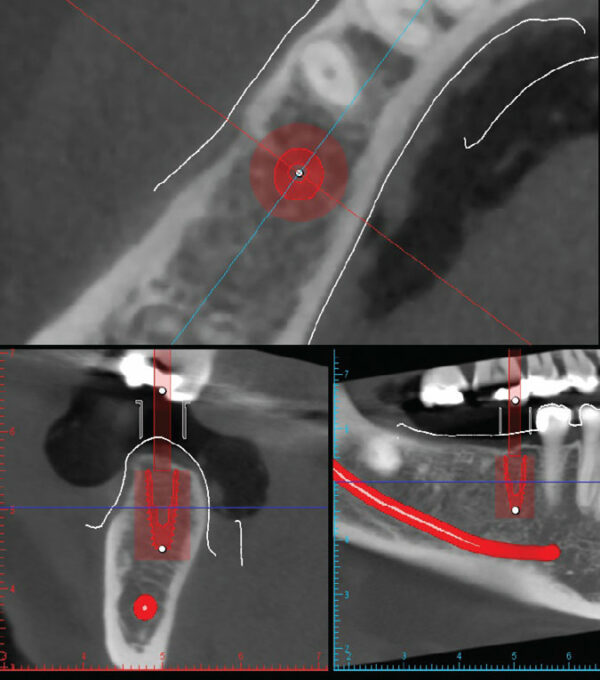 Utility of Cone Beam Imaging in Periodontics And Implant Therapy ...