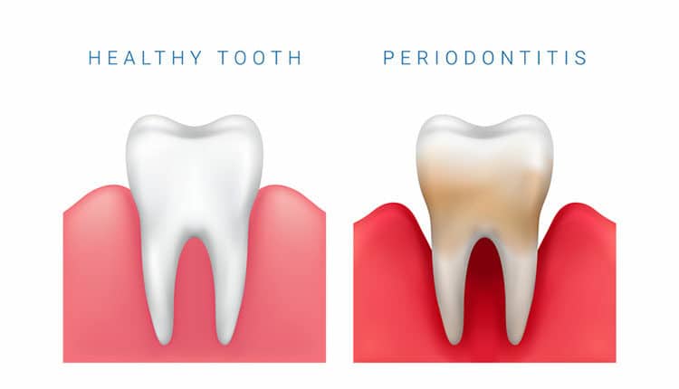 tooth-comparison