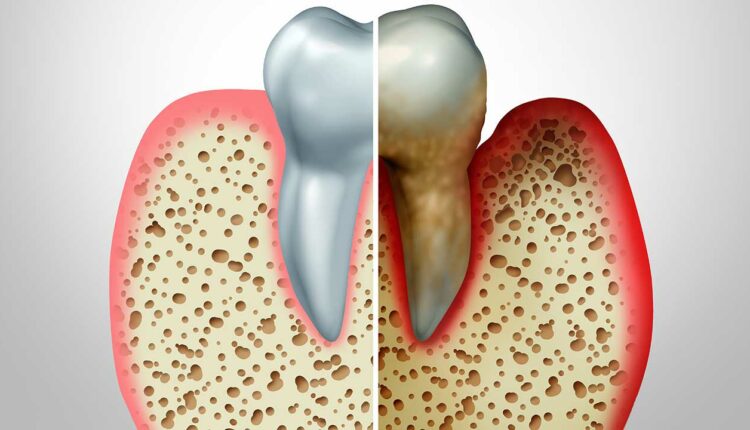 tooth-mirrored