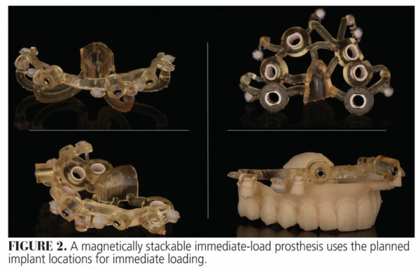 How 3D Printing Is Shaping the Future of Dental Care - Decisions in ...