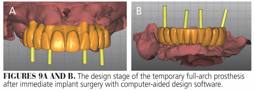 Optimize Workflow Efficiency by Integrating Dental Imaging Technologies ...