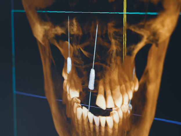 Exploring Dynamic Computer-Assisted Implant Surgery course image
