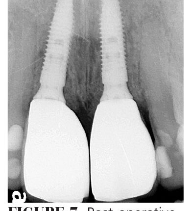 017_implants_10-17-(Page-17)-2