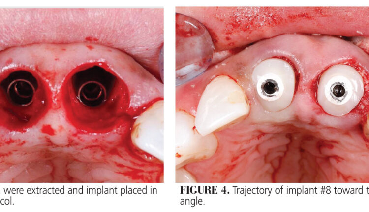 017_implants_10-17-(Page-17)-3
