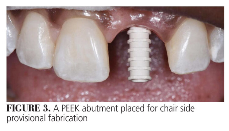 021_anterior-implant_18-21-(Page-21)