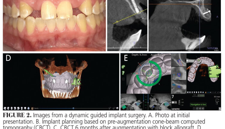 023_cbct_22-24-(Page-23)-2