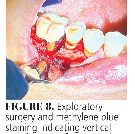 030_cracks-CE_28-31-(Page-30)-3