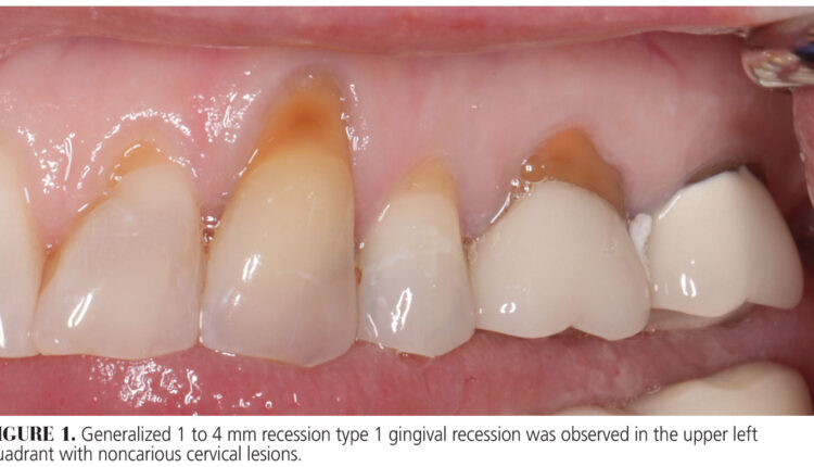 032_allograft-CE_32-35-(Page-32)
