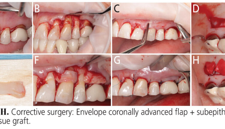033_allograft-CE_32-35-(Page-33)-2