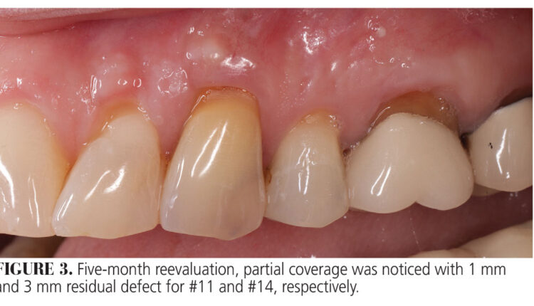 033_allograft-CE_32-35-(Page-33)-3