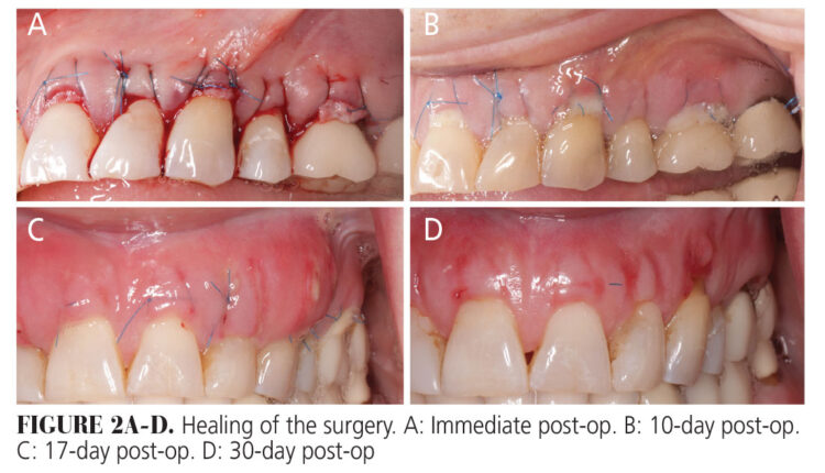 033_allograft-CE_32-35-(Page-33)