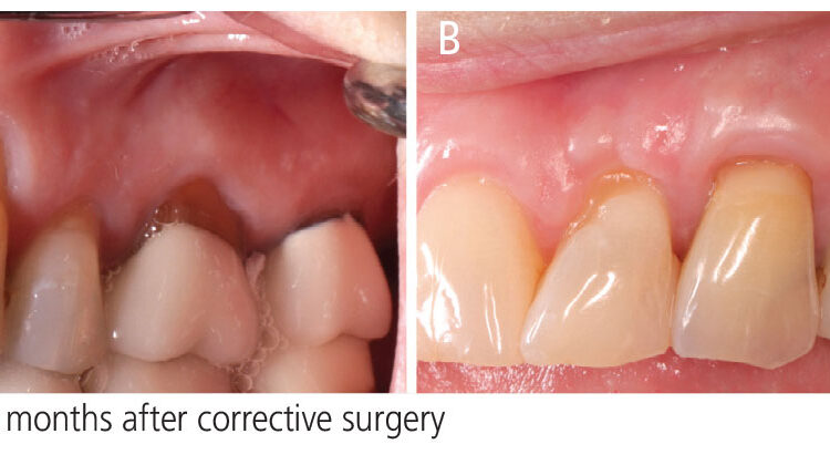 034_allograft-CE_32-35-(Page-34)-2