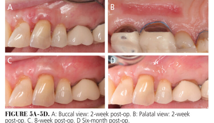 034_allograft-CE_32-35-(Page-34)
