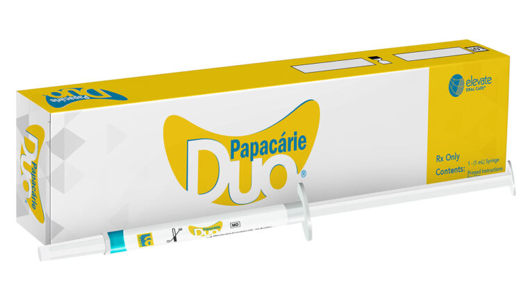 (featured)-Papacarie