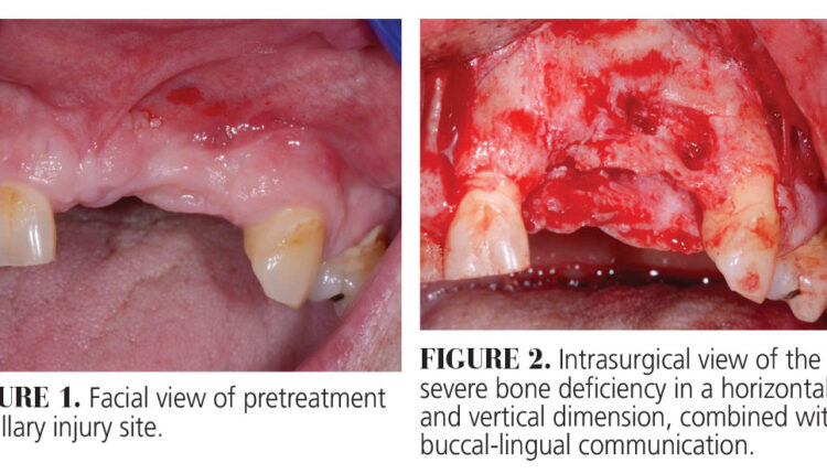 037_buccalDefects-CE_36-39-(Page-37)