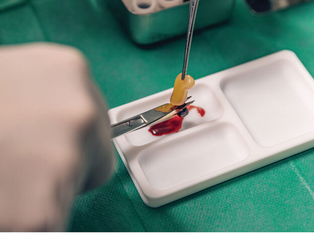 Unlocking the Regenerative Power of Platelet-Rich Fibrin course image
