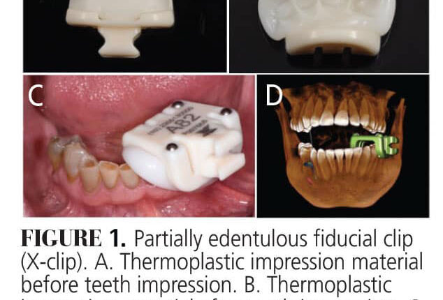 figure1