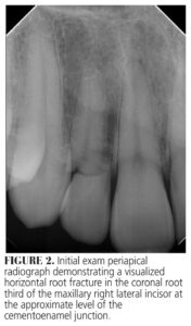 Endodontics CE page 37 (part 2)