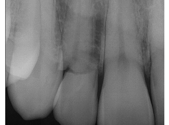 037_Endodontics-CE_36-39-(Page-37)-2