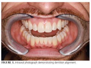Endodontics CE page 37 (part 1)