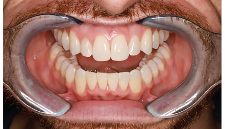 037_Endodontics-CE_36-39-(Page-37)