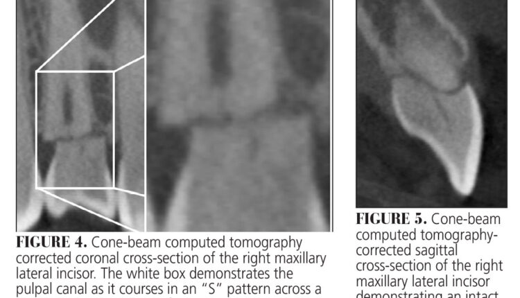 038_Endodontics-CE_36-39-(Page-38)-2
