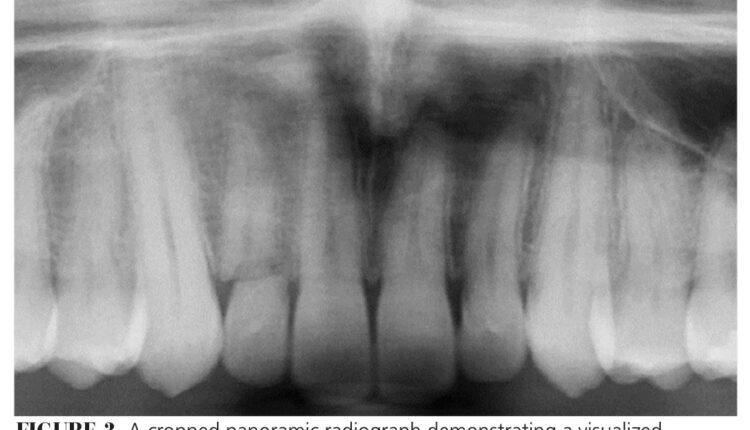 038_Endodontics-CE_36-39-(Page-38)