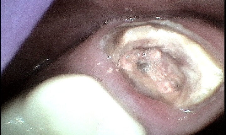 11. Figure 5B