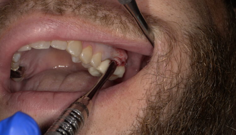 SHOFU DENTAL DIGITAL CAMERA