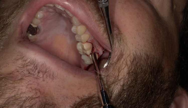SHOFU DENTAL DIGITAL CAMERA