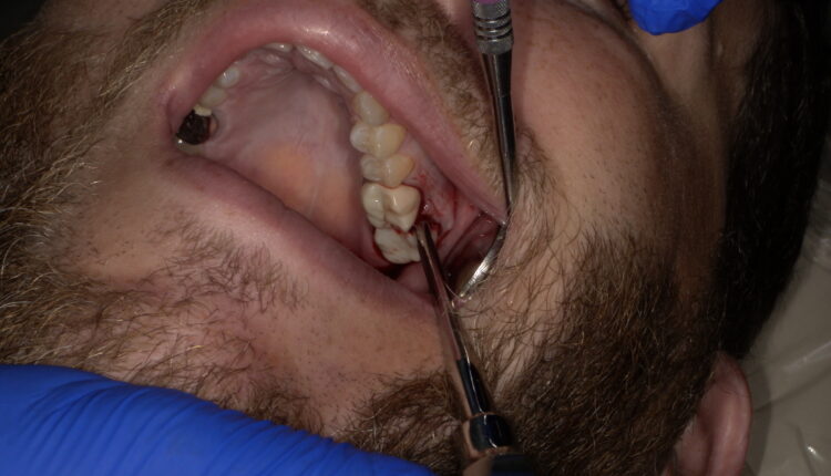 SHOFU DENTAL DIGITAL CAMERA
