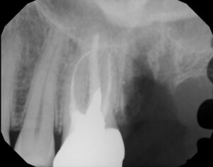 Figure 8A Post-op