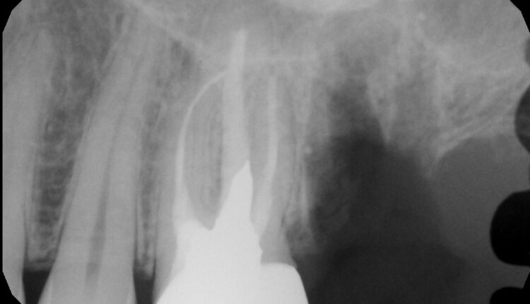 15. Figure 8A.Post op