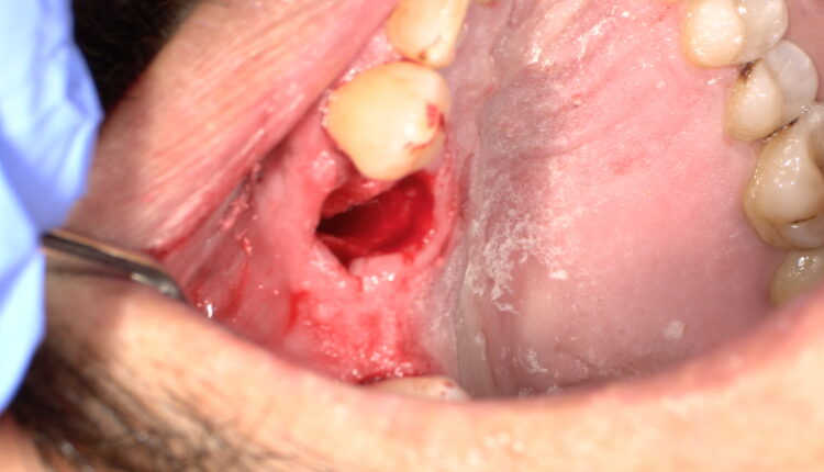SHOFU DENTAL DIGITAL CAMERA