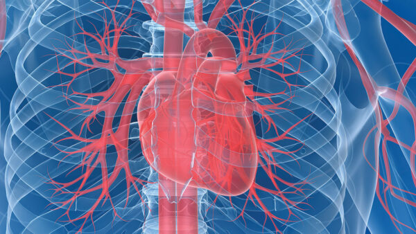 Preventing Infective Endocarditis