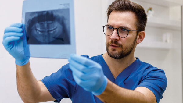 Conservative Management of Horizontal Root Fractures