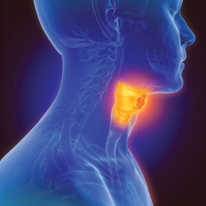 Managing Oral Mucositis