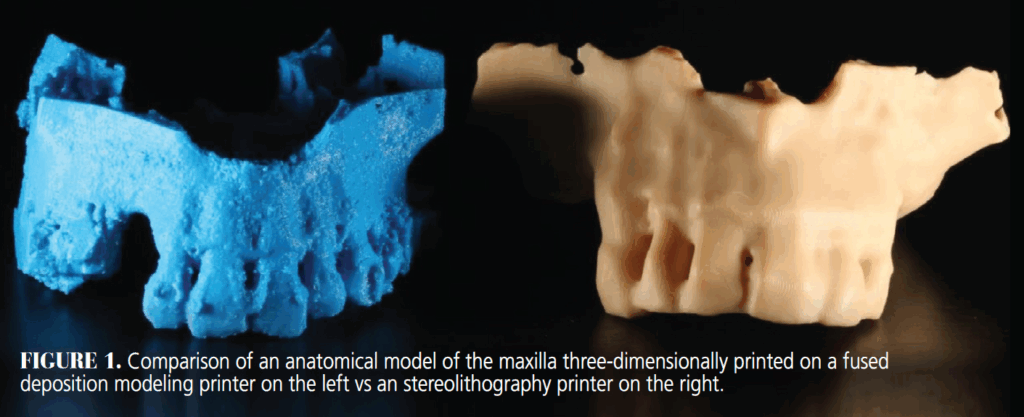 How 3D-Printing Is Reshaping the Dental Workflow - Decisions in Dentistry