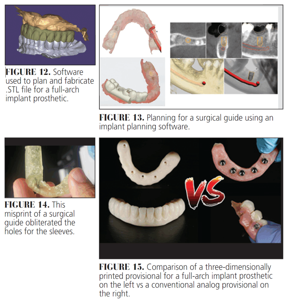 How 3D-Printing Is Reshaping the Dental Workflow - Decisions in Dentistry
