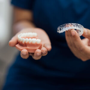 Clear Aligners vs Traditional Braces