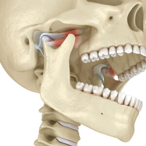 TMD Demystified: Practical Diagnosis and Conservative Management