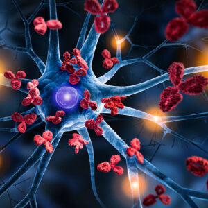 Recognize the Early Warning Signs of Autoimmune Disease